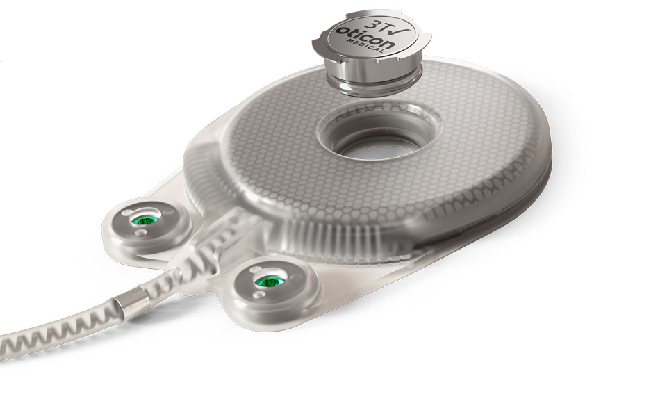 Neuro ZTI - safe for MRI scans